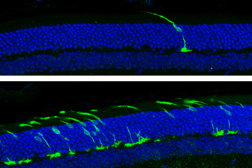 cones and photoreceptors